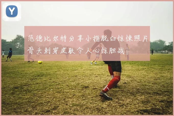 范德比尔特分享小指脱臼惊悚照片骨头刺穿皮肤令人心惊胆战